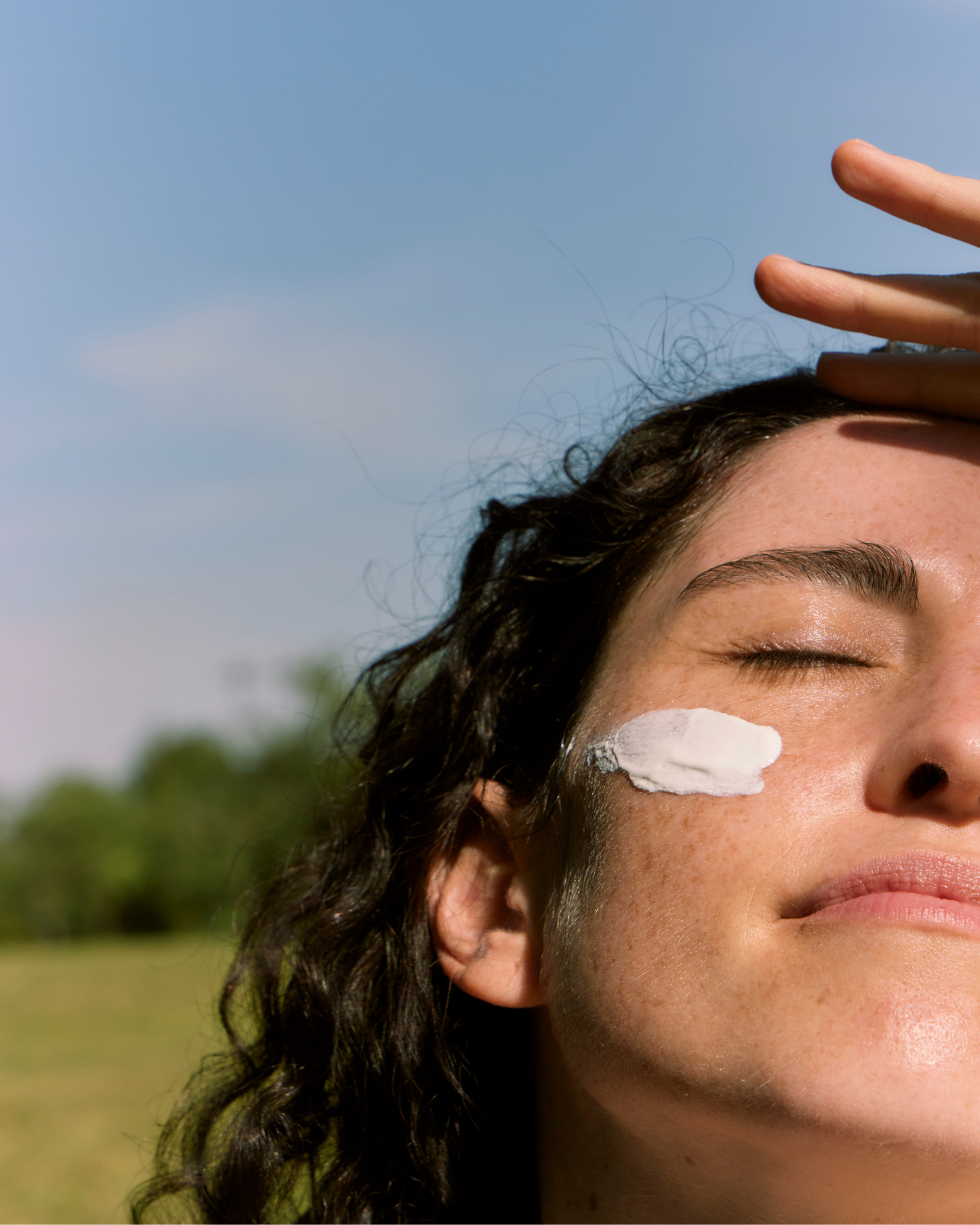 Pigmentation and Melasma: Whats the Difference? (it matters!!)